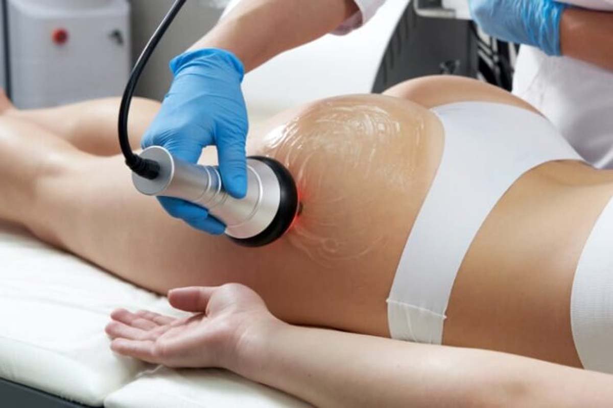 Anti-Cellulite Treatment2
